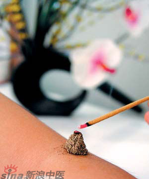 點擊將在新窗口查看全圖 艾灸為什么能防病治病?
