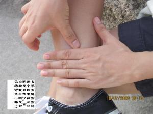 點擊將在新窗口查看全圖 五種肥胖的中醫艾灸減肥新方法【附圖文】